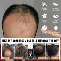 Crème de camouflage épaississante, spray brun foncé pour la ligne des cheveux et correcteur de cuir chevelu pour cheveux clairsemés, cache-taches chauves pour hommes avec système