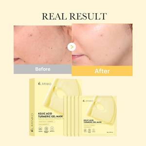 Etiqueta privada Cúrcuma Kojic Acid Jelly Gel Mascarilla facial Brillo Blanqueamiento Hidratante Reafirmante Productos coreanos para el cuidado <span class=keywords><strong>de</strong></span> <span class=keywords><strong>la</strong></span> piel - Product Image 3