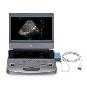 Échographe <span class=keywords><strong>portable</strong></span> <span class=keywords><strong>EDAN</strong></span> Acclarix AX8 sur chariot, échographe Doppler couleur 3D 4D, échographe cardiaque numérique - Product Image 6