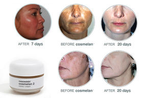 <span class=keywords><strong>Cosmelan</strong></span> <span class=keywords><strong>2</strong></span> Crème Visage | Dissolvant Taches Noires, Taches de Rousseur et Pigmentation pour Blanchir Tous Types de Peaux - Product Image 5