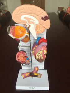 Modelo Anatómico de Cerebro Humano en Escala 1:1 de PVC con Modelo de Anatomía Patológica Hipertensiva - Product Image 4