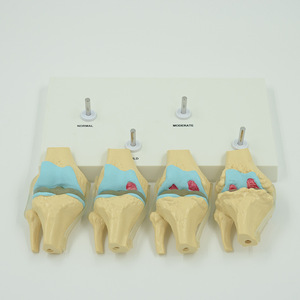 Le fabricant transforme et vend en gros des modèles de genou articulé à quatre étapes de développement ; manuel de chirurgie médicale du genou, des mains et des pieds. - Product Image 2