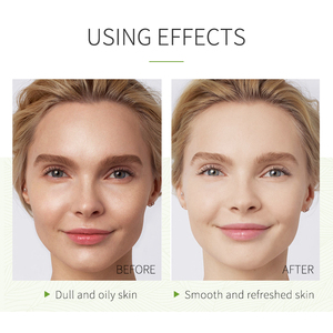 Produits de beauté pour soins de la peau en marque privée, masque à l'extrait de matcha vert biologique pour femmes, réparation de la peau et élimination de l'acné en marque privée - Product Image 5