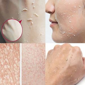 Gel Exfoliante para el cuidado de la piel, Gel Exfoliante para el acné, blanqueador y exfoliante - Product Image 3