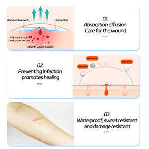 แผ่นปิดแผลไฮโดรคอลลอยด์แบบม้วนใส ปราศจากน้ำยาง ปลอดภัยต่อผิว ได้มาตรฐานทางการแพทย์ สำหรับดูแลสิวและ<span class=keywords><strong>แผล</strong></span>พุพอง ได้รับการรับรองมาตรฐาน CE/ISO - Product Image 6