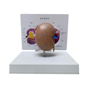 Modelo de anatomía renal felina con patologías comunes para la enseñanza veterinaria - Product Image 4