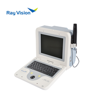 Échographe ophtalmique ABS-300 A/B avec sonde 10 MHz, formule IOL, mode immersion/contact pour clinique ophtalmique