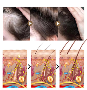 Fabbrica OEM rosmarino Batana Argan <span class=keywords><strong>capelli</strong></span> ispessimento siero per gli uomini donne intenso rafforzamento naturale dei <span class=keywords><strong>capelli</strong></span> riparazione aumento Volume - Product Image 3