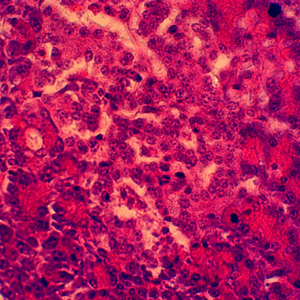 China-made Mixed Animal Pathology Prepared Slides Set Glass Microscope Slides for Medical Teaching in University and <strong>Lab</strong> - Product Image 4