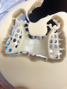 Vsmile Acétal Flexible <span class=keywords><strong>Pmma</strong></span> Blocs Laboratoire dentaire Cadcam fraisage Matériaux consommables 10-25mm
