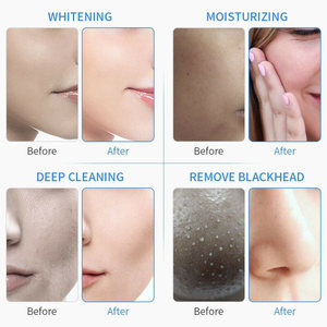 เครื่องทำความสะอาดผิวหน้า 7 in 1 ระบบไฮโดรไมโครเดอร์มาเบรชั่น - Product Image 6