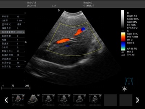 Dawei-Doppler de Color para uso veterinario, instrumento de ultrasonido portátil para clínica de mascotas - Product Image 5