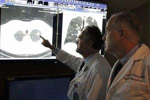 Hastaneler/Klinikler ve PET Kullanımı için Sıcak Satış A3/A4/A5 Beyaz Lazer Tıbbi Röntgen Filmi - Product Image 6