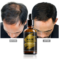 Aceite de argán orgánico profesional para la pérdida del cabello, aceite de reparación profunda a granel para el crecimiento del cabello