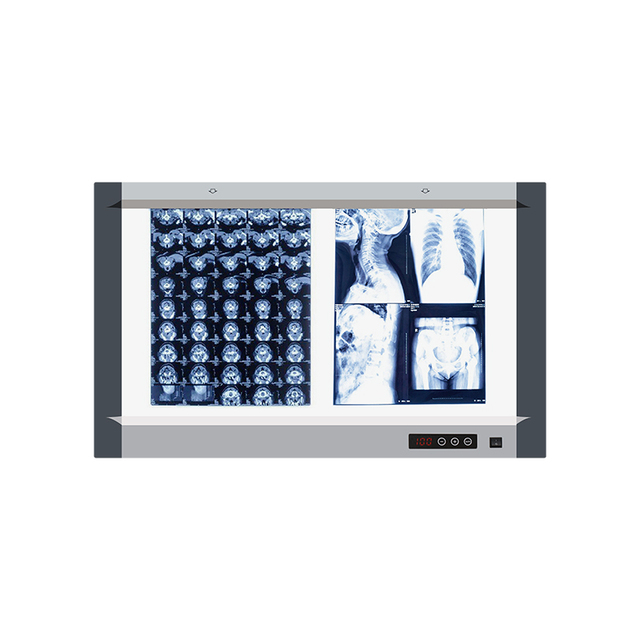 MG02 Double Panel Digital Display LED X-Ray Film Viewer with Adjustable Brightness for Medical and Industrial NDT