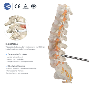 Juego de Instrumentos Quirúrgicos para Cirugía Espinal UBE Directo de Fábrica, Instrumental Quirúrgico para Endoscopia Espinal Mínimamente Invasiva, con Certificación CE - Product Image 2
