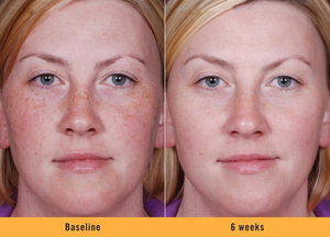 Siero schiarente schiarente schiarente della pelle del viso dell'oem con acido Kojic arbutina Niacinamide MAP vitamina C acido ialuronico - Product Image 2