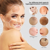 NOUVEAU Crème anti-boutons pour l'élimination des mélasmas et des imperfections Correcteur des taches foncées Blanchiment fort Blanchiment du visage Taches de rousseur Hyperpigmentation