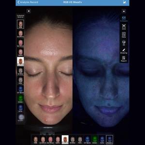 Analyseur de peau facial MC88 AI avec technologie de topographie 3D pour l'analyse de la pigmentation, de l'acné et des rides, écran iPad - Product Image 2