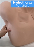 Modèle de Drainage Thoracique pour la Formation en Ponction de Pneumothorax et Hydrothorax – Simulateur de Formation Clinique