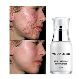 เจลกำจัด<span class=keywords><strong>สิว</strong></span> 30 มล. ไม่มีโลโก้ เจลลดสิว บำรุงผิว ควบคุมความมัน ปลอบประโลมผิว ซ่อมแซมผิวจากสิว บำรุงผิวหน้า - Product Image 3