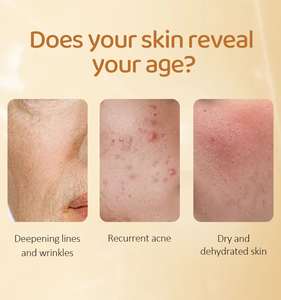 Siero Viso all'Acido Kojico, Curcuma e Niacinamide 80ml, Anti-Acne, Sbiancante, Anti-Macchie Scure, Siero per la Cura della Pelle - Product Image 4