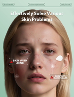 Micro-Point clair soins de la peau acné bouton Patch Spot huile d'arbre à thé Invisible Micro aiguille visage patché marque privée