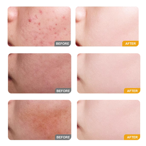Set de Cuidado Facial Iluminador de Yuja y Niacinamida de <span class=keywords><strong>30</strong></span> Días, Incluye Limpiador Facial, Tónico, Sérum y Crema Facial, Set de Cuidado Facial MOOYAM - Product Image 6