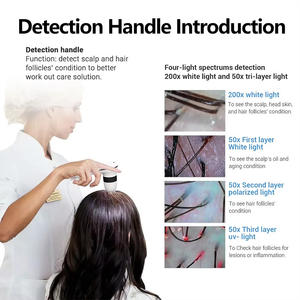 Appareil professionnel 5-en-1 pour le soin du cuir chevelu : analyse capillaire + massage + anti-chute + stimulant de la pousse avec mode <span class=keywords><strong>comparatif</strong></span> - Product Image 4