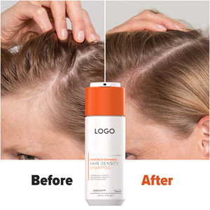 Crème Virale <span class=keywords><strong>TikTok</strong></span> pour Cheveux Clairsemés, Formule Volumisante et Épaississante à Base de Plantes, Favorise la Croissance et Renforce les Cheveux, Unisexe, OEM/ODM, 7 Fl oz - Product Image 1