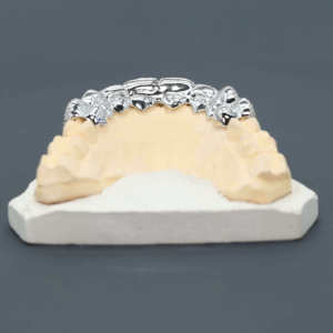 Grillz de Lujo de Plata de Ley 925 con Diamantes de Moissanita para Hombres y Mujeres, Joyería Única de Hip Hop con Dientes Personalizados Iced Out - Product Image 3