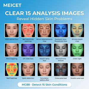 Analizador de Piel Portátil MC88 con Tecnología IA, Escáner Facial para Uso Comercial en Estética, Compatible con EU, JP, ZA, US, IT, 3D - Product Image 5