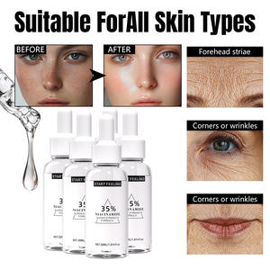 Skincare Serum Niacinamide 35% Super Strength Serum Brightening Hydrating <b>Face</b> Serum Evens Skin Tone Fast Absorb All Skin Types - Product Image 5