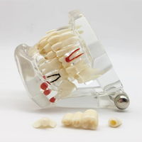 Étude orthodontique standard dentiste restauration anatomique implant dentaire modèle de prothèse dentaire