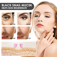 Nouveau sérum pour le visage d'escargot anti-rides sérum réparateur de peau lifting raffermissant fondu ridules niacinamide sérum de soin de la peau blanchissant