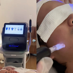 Appareil de beauté à plasma froid et ozone pour l'élimination des poches sous les yeux, traitement facial, nettoyage et lifting cutané par jet plasma - Product Image 6