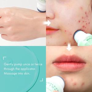 Custom Pore Control Calming Nourishing Acne Treatment Soothing <b>Toner</b> Centella Asiatica Heartleaf Tea Tree Serum - Product Image 5