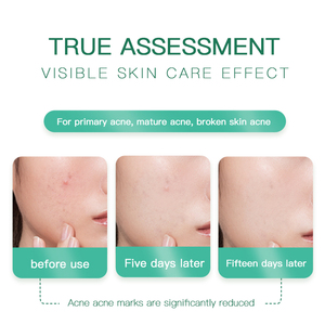 <span class=keywords><strong>Gel</strong></span> apaisant 100 % naturel pour le visage et le corps à l'aloe vera, hydratant, vente en gros <span class=keywords><strong>d</strong></span>'usine - Product Image 3