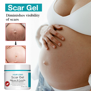 Gel Cicatrisant OEM ODM au Silicone et Centella Asiatica pour Réduire les Rougeurs, les Démangeaisons, Apaiser et Adoucir les Chéloïdes, Vergetures et Cicatrices de Brûlures - Product Image 4