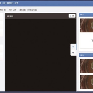 เครื่องมือตรวจตา ออฟทัลโมสโคป ตรวจอาการตาแห้ง เมย์โบกราฟี DEA800 - Product Image 5