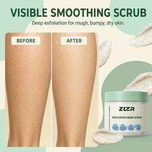ครีมบำรุงผิว ZLZR AHA สำหรับผิวแห้ง หยาบกร้าน ขรุขระ รักษาอาการเคอราโทซิส พิลาริส ใช้ที่บ้าน - Product Image 3