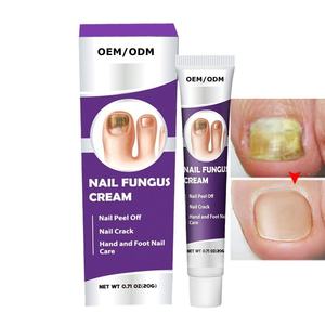 Perlengkapan kesehatan terlaris untuk krim perbaikan herbal alami anti-infeksi Pembersih Pemutih makanan perawatan jamur - Product Image 1