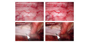 Camjoy 0 Degré 4mm 175mm Endoscope Nasal Ensemble d'Instruments Chirurgicaux Acier Inoxydable Manuel Source d'Alimentation Modèle 4175.00 CE - Product Image 6