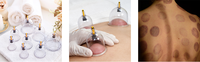 Chinois pas cher hijama ensemble pression négative ventouses machine hijama 12 ventouse kit ventouses outil