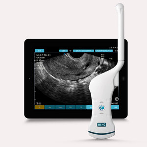 Mesin Pemindai USG Genggam Peralatan Ginekologi Elektrik <span class=keywords><strong>Probe</strong></span> Ganda <span class=keywords><strong>Probe</strong></span> Cembung Transvaginal - Product Image 1