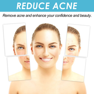 OUHOE Gel Réparateur Visage à l'Acide Salicylique Contre l'Acné, Estompe les Marques et Élimine les Points Noirs, Soin de la Peau 20g - Product Image 5
