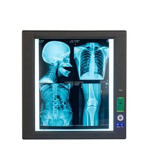 Visionneuse de films radiologiques LED électrique portable avec certification CB pour la radiographie hospitalière - Product Image 4