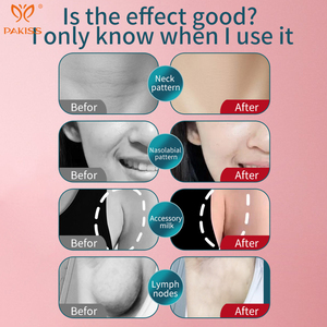 Masajeador Facial PAKISS, Dispositivo Portátil de Vibración para Reafirmar la Piel, Cuidado Facial, Recargable por USB - Product Image 4