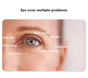 Ringiovanimento della pelle attrezzatura portatile per la cura degli occhi dispositivo galvanico per il sollevamento degli occhi bastone per il massaggio degli occhi