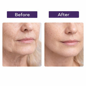 Crema Facial 3D Reafirmante y Tensora, Hidratante para Piel Flácida, Tratamiento Contorno con Péptidos para una Línea de Mandíbula Definida - Product Image 4